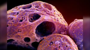 XBB.15 subvariant cases double in one week, reports PHAC