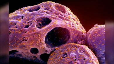 XBB.15 subvariant cases double in one week, reports PHAC