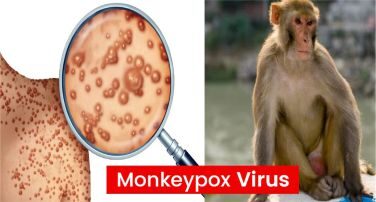 Scary thing came to the fore about monkeypox